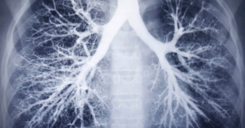 American Lung Association Joins The Fight Against COVID-19