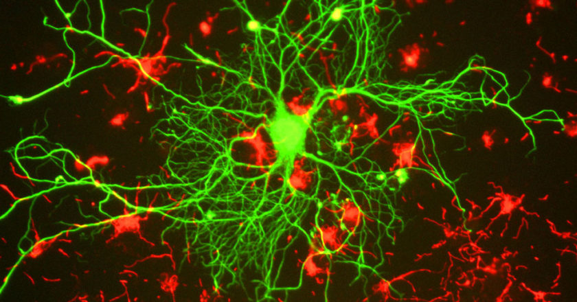 COVID-19 and Neural “Rewiring”